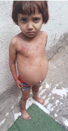 معاناة الطفلة جودي حنون معاناة الطفلة جودي حنون