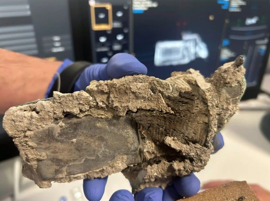 حقيبة محفوظة تحتوي على أدوات طبية حقيبة محفوظة تحتوي على أدوات طبية
