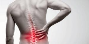 أسباب ألم الظهر والأعراض والعلاج