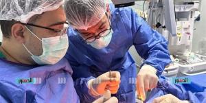 نجاح جراحة دقيقة لإصلاح انسداد القنوات الدمعية بمستشفى رمد قلاوون