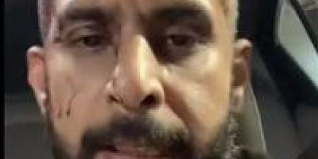 خرمولي
      جسمي..
      الأمن
      يفحص
      فيديو
      التعدي
      على
      سائق
      بالصحراوي
      في
      الجيزة