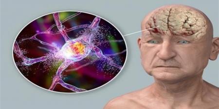 اكتشاف
      مؤشر
      بيولوجي
      لتسارع
      شيخوخة
      الدماغ