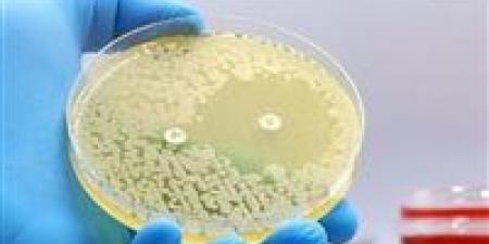 ثورة طبية .. الذكاء الاصطناعي يكتشف مضادات حيوية تهزم أخطر البكتيريا المقاومة