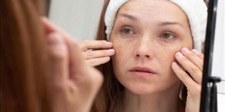 علامات نقص الفيتامينات في الجسم.. إشارات تحذيرية لا يجب تجاهلها