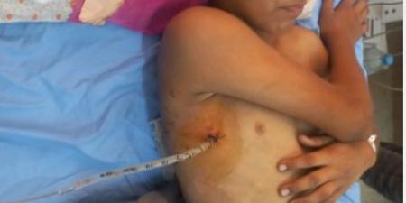 طفل فلسطينى يواجه مصيرا مجهولا وصرخة عاجلة لإنقاذه من قلب غزة