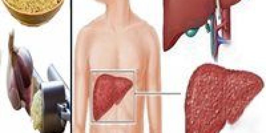 أطعمة
      بسيطة
      تحمي
      الكبد
      من
      الخطر
      الصامت