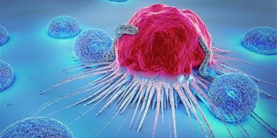 أعراض إذا استمرت 3 أسابيع تستدعي فحص السرطان فورا