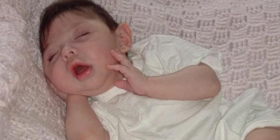 فتاة "المعجزة" تحتفل بعيدها العشرين متحدية توقعات الأطباء