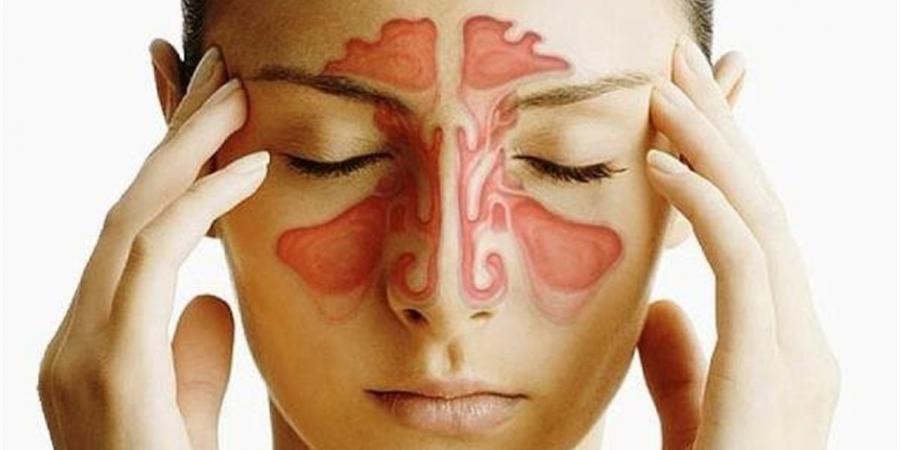 طبيبة توضح العلاقة بين نزلات البرد والتهاب الجيوب الأنفية