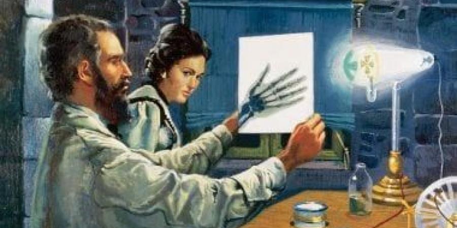 أول صورة بالأشعة السينية عام 1896.. كيف غيرت تاريخ الطب