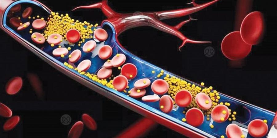سرّ بسيط لصحة القلب.. أطعمة تخفض الكوليسترول خلال أسابيع