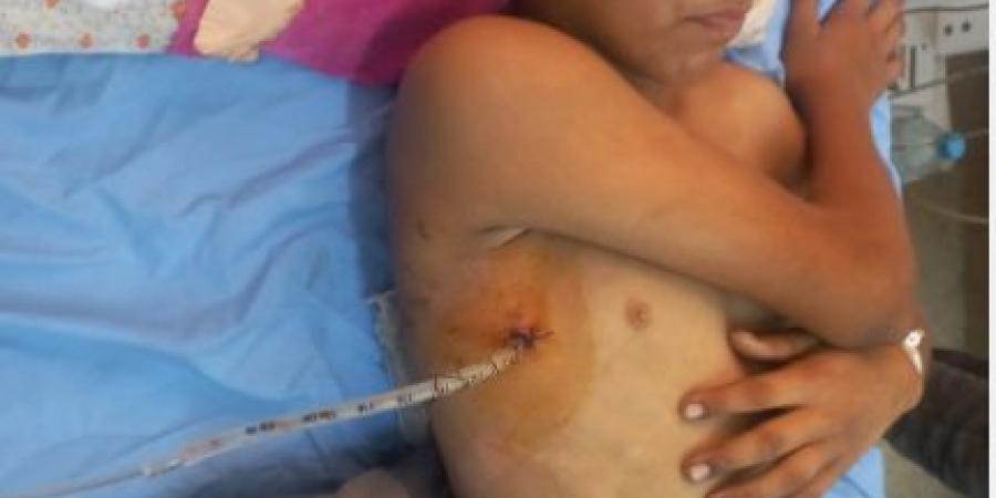 طفل فلسطينى يواجه مصيرا مجهولا وصرخة عاجلة لإنقاذه من قلب غزة