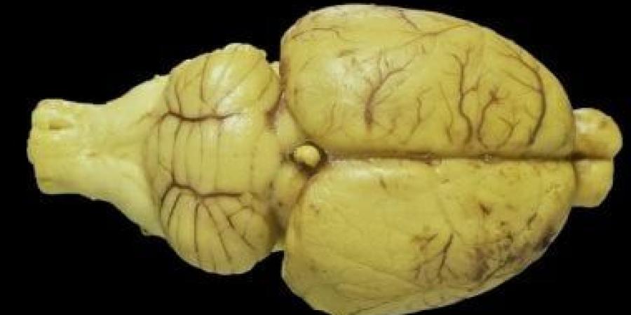 تجربة ثورية.. باحثون يدرّبون خلايا عصبية حية لتنفيذ مهام ذكاء اصطناعى