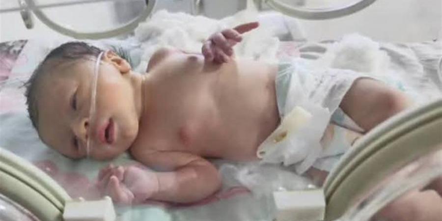 على خُطى «حكاية نرجس».. جدل واسع حول واقعة خطف رضيعة داخل مستشفى الحسين الجامعي (فيديو)