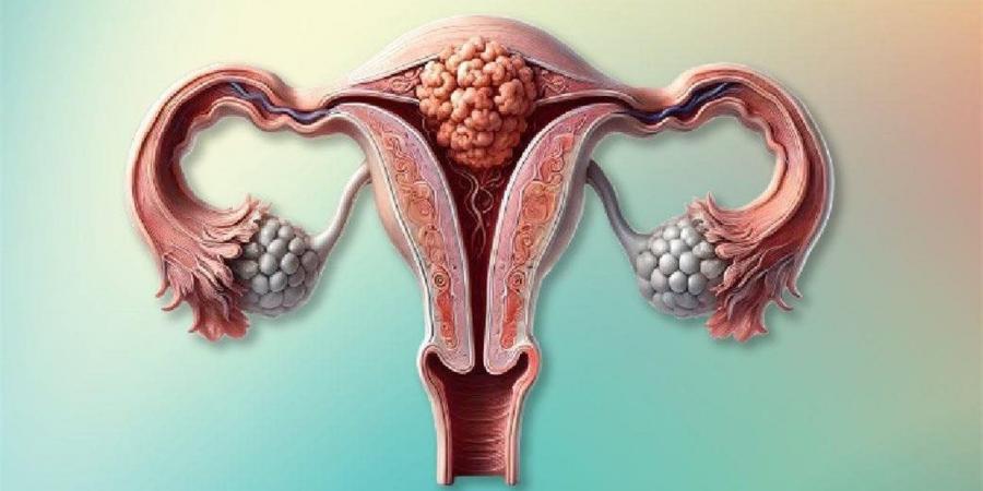 "الصحة": الفحص المبكر لعنق الرحم يحمي السيدات من السرطان