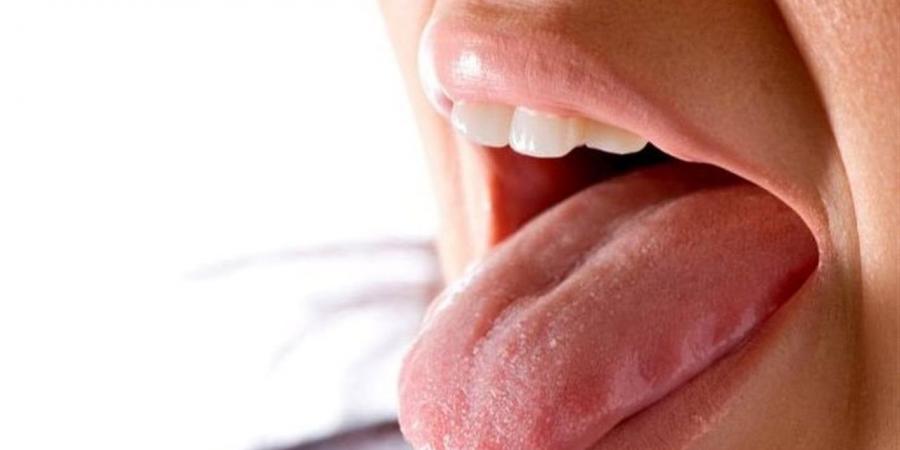 أمراض خطيرة تختبئ وراء جفاف الفم