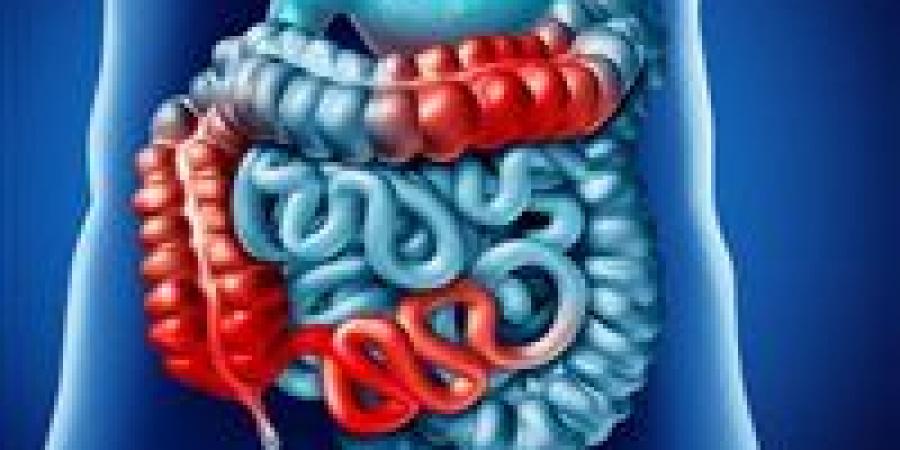 دراسة حديثة: الصيام المتقطع يهزم كرون بنسبة 40% ومفاجأة في الوزن