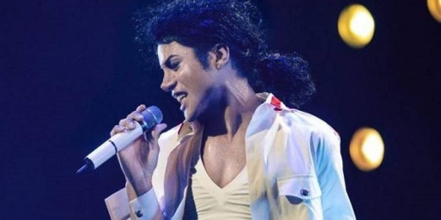 جدل قديم يتجدد حول مايكل جاكسون ومرض البهاق