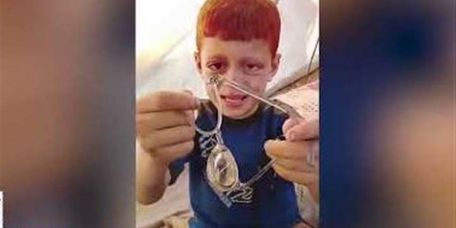والد الطفل أيوب: اللجنة المصرية أعادت البسمة لابني بعد توفير نظارة جديدة