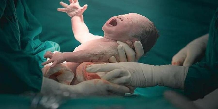 هل تعرضتِ للعنف التوليدي؟.. محاميات يستعرضن حقوقك القانونية داخل غرف الولادة